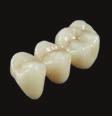 Ideal for anterior crowns and veneers, inlays/onlays and posterior single crowns. Super Translucent Multi-Layered.