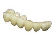 High fl exural strength zirconia is suitable for single unit frameworks and long-span bridges.