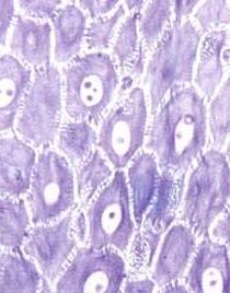 Epidermis: Stratum Spinosum prickly layer because of cell junctions where