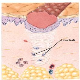 Repair of Skin Injuries Step 3 Specialized cells, called
