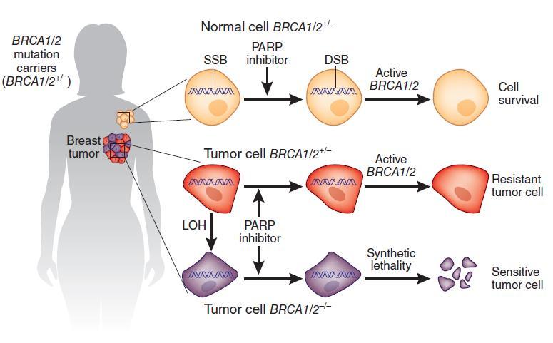Synthetic Lethality in Tumors From BRCA Mutation Carriers Treated