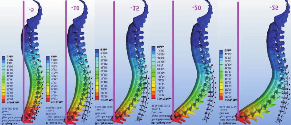 Figure 4 shows distribution of effective stresses in various parts of spine and in various parts of vertebrae.