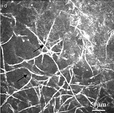 (2004) Fungal Fusarium Solani (Fungal hyphae) Linear structures up to 300 μm length,
