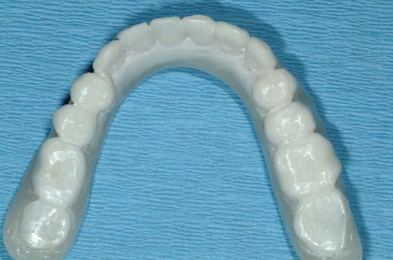 can occur with the knowing where teeth and the prosthesis should be ideally end up.