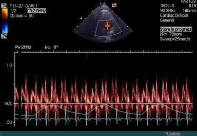 158 Establishing Better Standards of Care in Doppler Echocardiography, Computed Tomography and Nuclear Cardiology Fig.