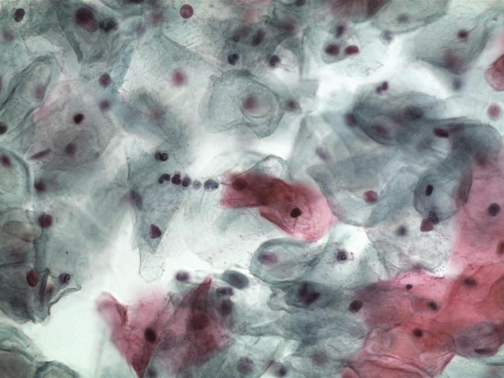 March 2008: cytology vaginal