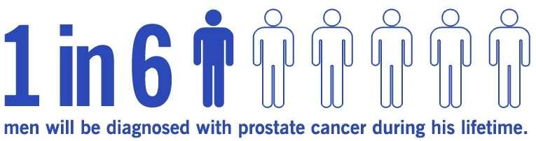 PROSTATE CANCER EPIDEMIOLOGY 2 nd leading cause of cancer death in men. In developing countries it can be 1 st cause.