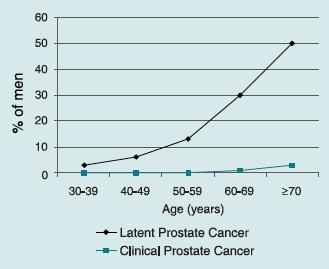 INDOLENT PROSTATE CANCER Autopsy studies Men may live their entire natural life without having any symptoms from prostate cancer Study Country N Detection rate % 1994 US 249 24 2005