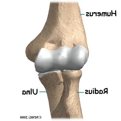 The Elbow Joint 2 articulations The humeroulnar joint Structural stability for the joint: trochlear notch The