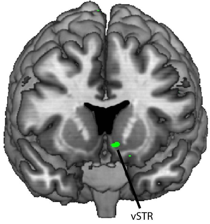 Figure S5: Monetary rewards evoke activation in vstr Our initial analysis found that monetary rewards activate regions of the vmpfc and frontopolar cortex, but did not find significant vstr