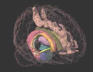 Declarative memory: Hippocampus / Medial Temporal lobe Paragraph recall, Complex figure Working memory: