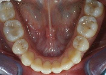 J. Bennett, R.P. McLaughlin. Journal of Clinical Orthodontics.