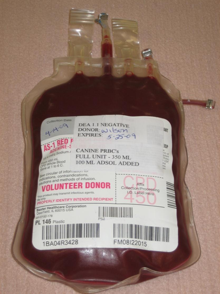 70-90% of patients require transfusion Transfuse if clinical for anemia!