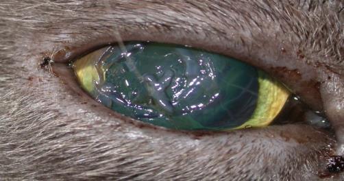 Ocular Bandage Gel (OBG) Eye Drop A device with no predicate as it is the first prescription HA eye drop in the U.S.