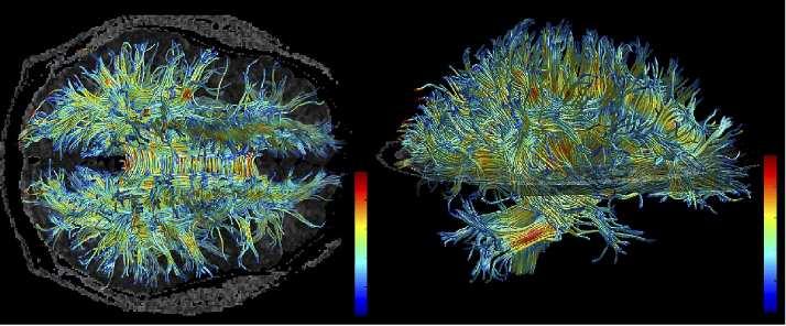 Grey and white matter Grey matter soma, performs computations White matter (60% of brain) axons, transmits information Tractography finds links