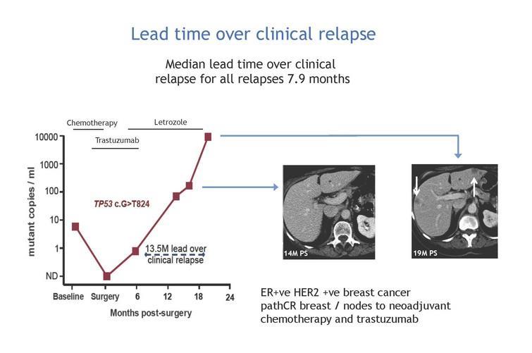 Early stage: Prognosis Prediction of relapse in early breast cancer