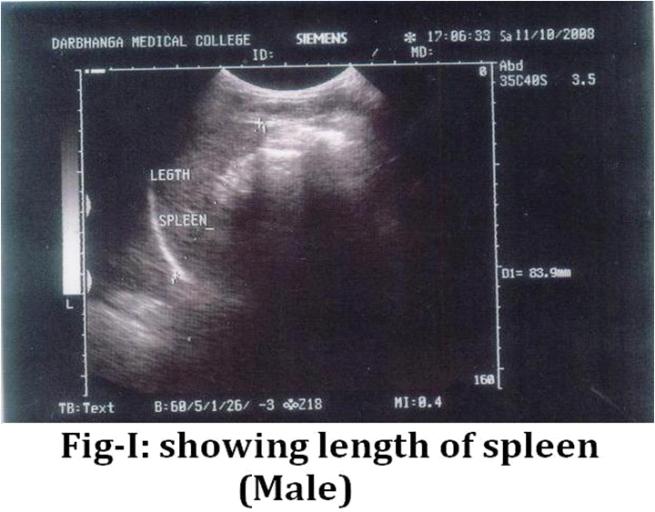 Ultrasonographic Measurement of Splenic is often important in the diagnosis, treatment and prognosis of a variety of disorders.
