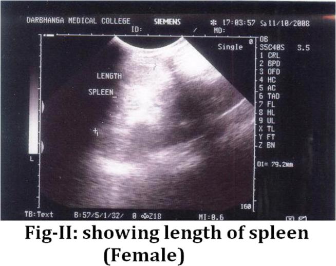 In some cases a normal sized spleen is palpable whereas a nonpalpable spleen is not always normal sized, hence comes the importance of imaging techniques.