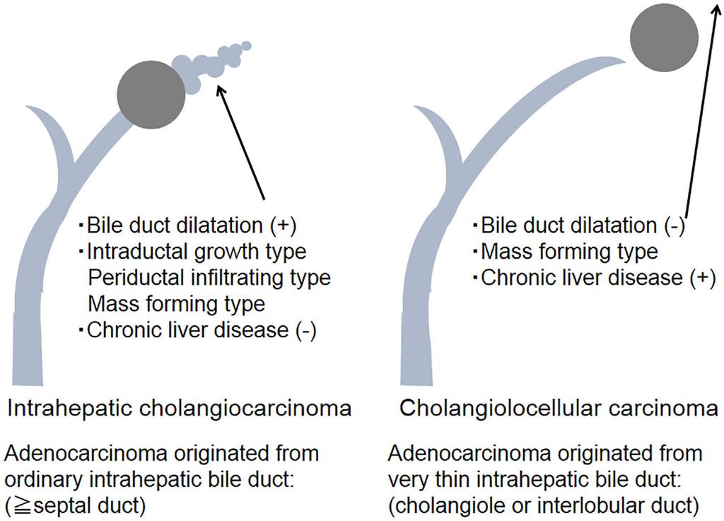 Figure 3. Comparison of the imaging and clinical findings of ordinary ICC and CoCC. Figure 4. Immunohistochemistry for EMA in the CoCC and various non-neoplastic small bile ducts.