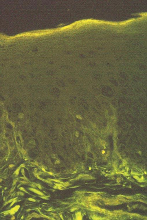 Pigmented cells with no specific fluorescence (C) (Fluorescence method, 1765).