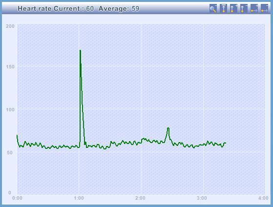 When the software detects a good signal the trace will change to a wave like pattern. Wait a few seconds until clean and regular pulse wave appears.