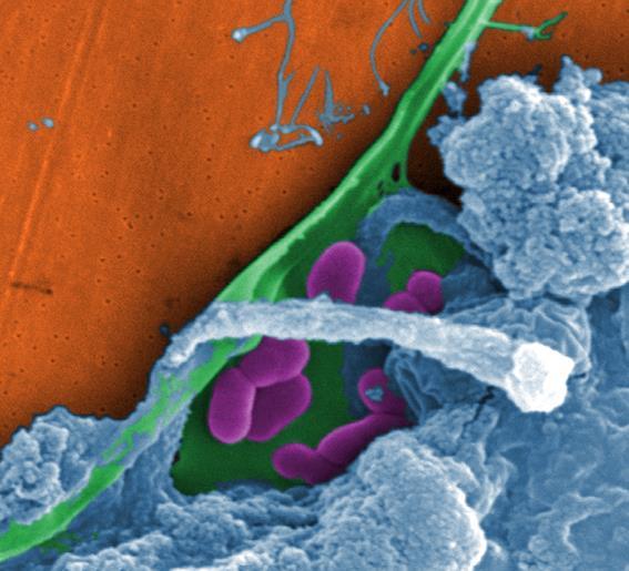Biofilm Microbes live naturally in biofilms communities that may consist of one or several species of bacteria
