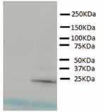 ExoCap Ultracentrifugation/Storage Booster (ExoCap USB) Improve the recovery rate of exosomes from cell culture supernatant using ultracentrifugation Increase stability using low temperature storage