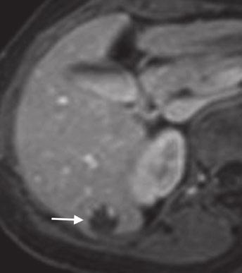 phse of gdoxetic cidenhnced MRI c Fig. 17.