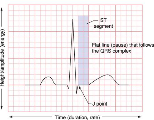 Flat line that follows the QRS complex and connects it to T wave ST Segment I OAAPN