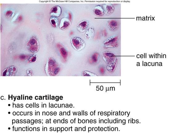 Cartilage Cells are in chambers Lacunae Lacunae surrounded by a matrix No direct blood supply Cells Cartilage Chondrocytes s Nose, ends of