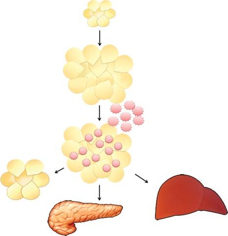 Adipose Weight gain Adipose tissue expansion Macrophage infiltration TNF-α IL-6 Insulin resistance Lipolysis FFA generation Leptin Adiponectin Adipose Liver Pancreas Insulin sensitivity Pancreatic