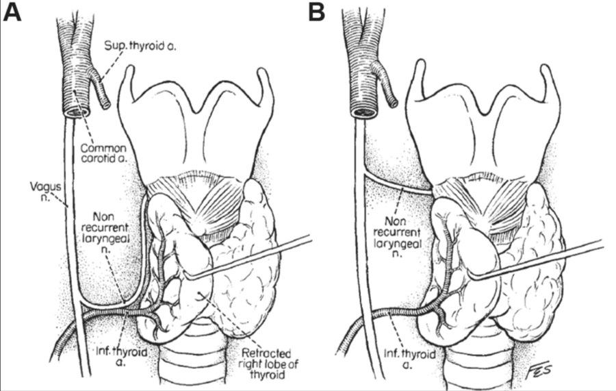 laryngeal nerves (SLN).