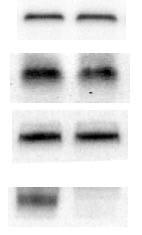 Canalicular Transport Protein Expression on Day 4 in Control and TR