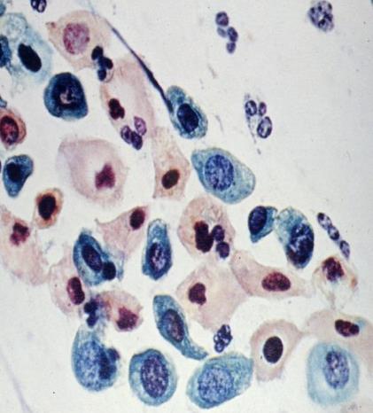 Cytoplasm cyanophilic nuclei round or oval with finely granular chromatin and small nucleoli.