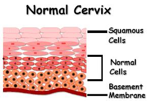 The outside of the cervix and the vagina are covered by a layer of flat cells called squamous or skin-like cells.