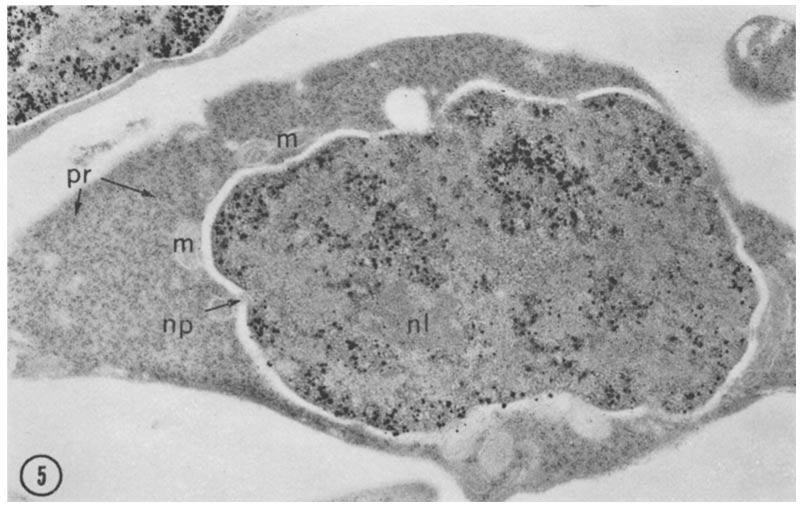 FIGURE 5 A small basophilic erythroblast contains cytoplasmic ribosomes arranged in clusters as polyribosomes (pr) and mitochondria (m).