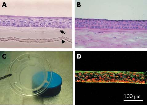 1282 Nakamura, Inatomi, Sotozono, et al Figure 1 Cultivation of oral epithelium on amniotic membrane.