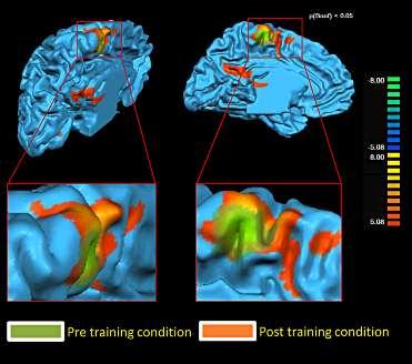 After the training brain activations increase in: premotor areas