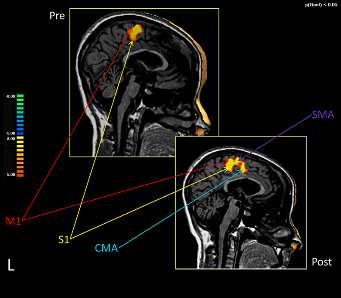 (M1) primary sensory area (S1) at the level of the foot cortical