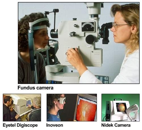 Screening and Diagnosis for Diabetic Retinopathy History/physical exam Refer once per year to an ophthalmologist for a dilated eye exam In-office screening can be conducted with a Fundus camera and