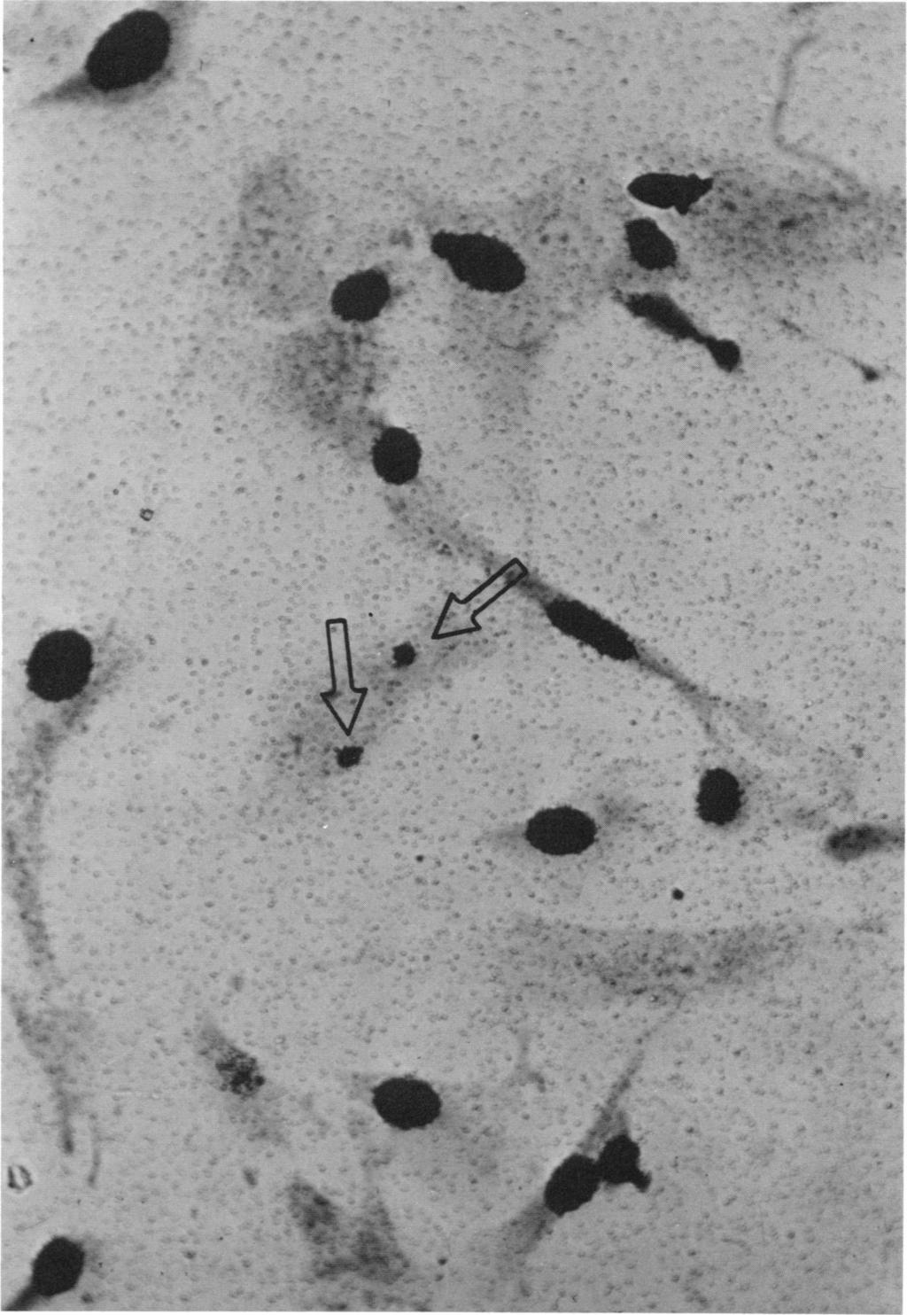 VOL. 24, 1972 ASSAY OF PARAVACCINIA VIRUS 141 Downloaded from http://aem.asm.org/ FIG. 4. Same monolayer as in Fig. 3 after completion of autoradiography.