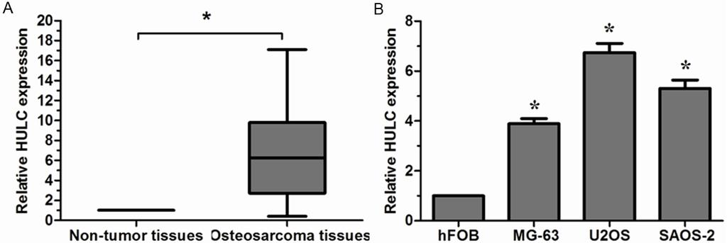 Figure 1. Relative HULC expression in osteosarcoma tissues and cell lines. A. Relative expression of HULC in osteosarcoma tissues in comparison with adjacent non-tumor tissues; B.
