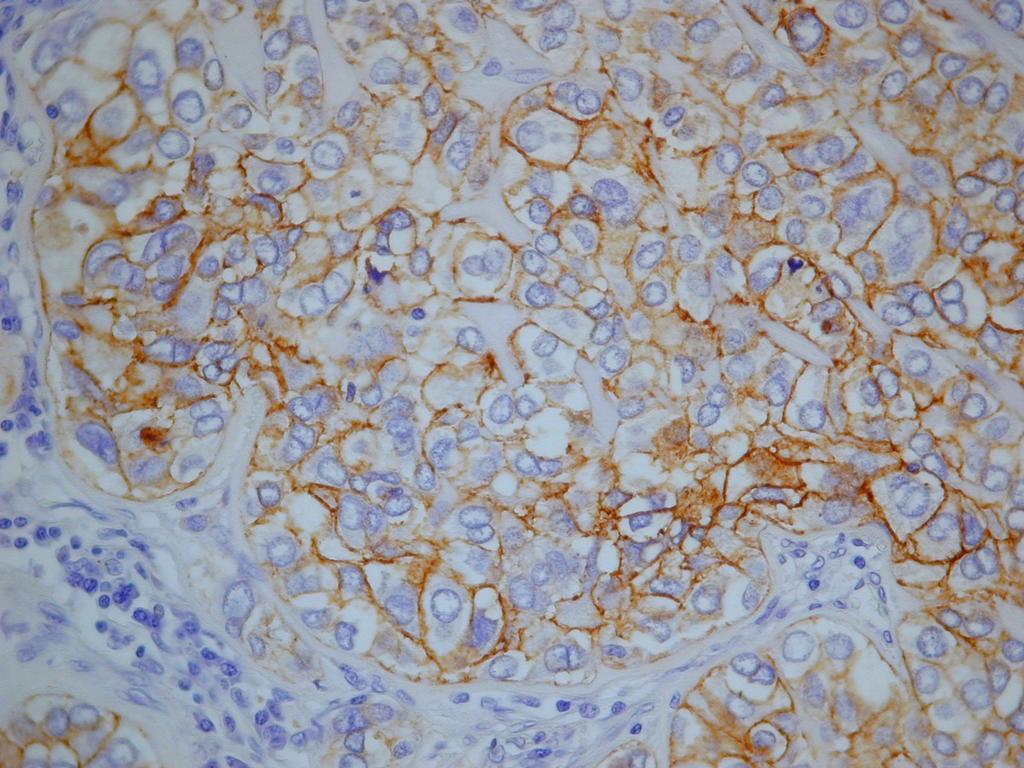 Immunohistochemistry (IHC): characteristics and aim Marked antibodies to detect receptor activity Tool for clinical applications Correlation of staining