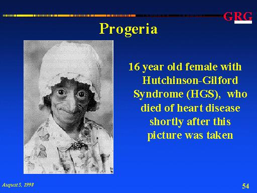 Werner s syndrome Werner s syndrome Clinical features Also called adult progeria.