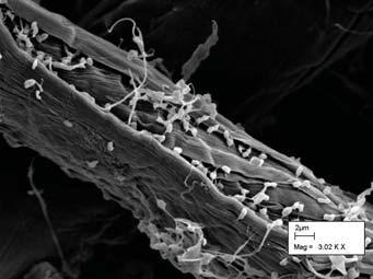 Microbial Attachment Surface Area Bacteria attacking