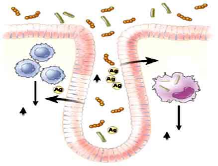 Two potential causes of IBD 1. Bad intestinal bacteria induces IBD Inflammatory cytokine 2.