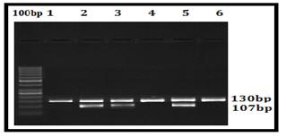 CYP3A5*3 RFLP Agarose Gel Picture; Lane 0, 100bp Ladder; Lane 1, 4 and 6, 130bp Wild type (Normal); Lane 2, 3 and 5, 130bp, 107bp and 23bap heterozygous mutant (Abnormal) these were 21-30, 31-40,