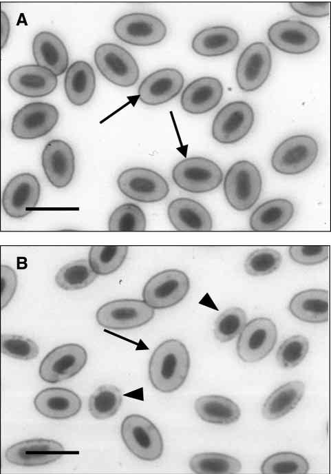 328 T. LECKLIN, A. TUOMINEN AND M. NIKINMAA 12 A Cell number 9 6 3 15 225 3 375 Cell volume (µm 3 ) Change in cell volume (%) 12 1 8 6 4 