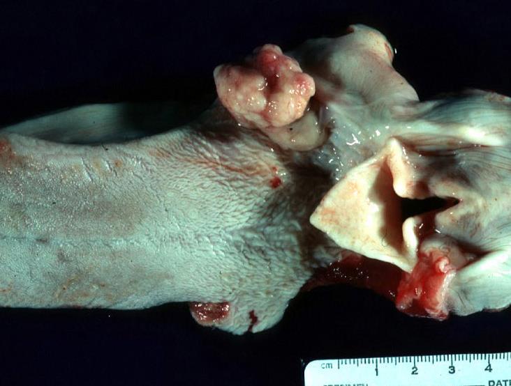Squamous cell carcinoma (SCC) Noah s