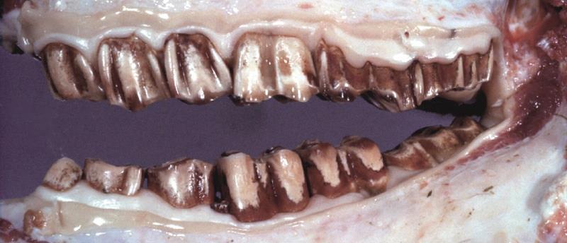 1.2 Abnormal teeth coloration Tetracyclines